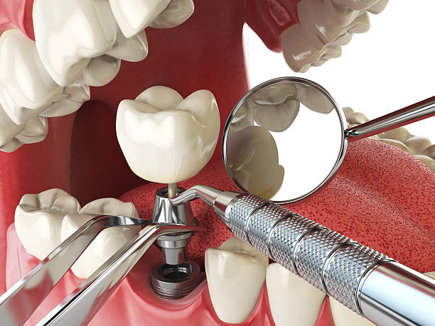 Best Emergency Tooth Extraction in South Shore, KY